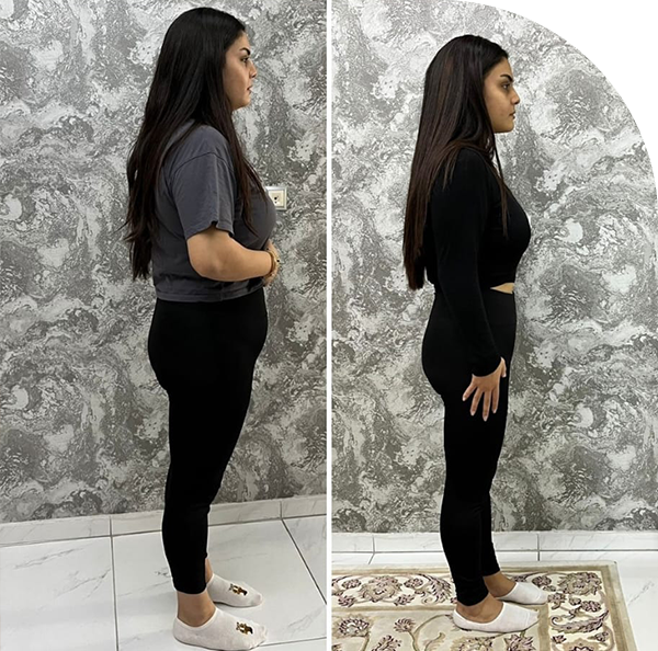 Diyetisyen Merve Akın 